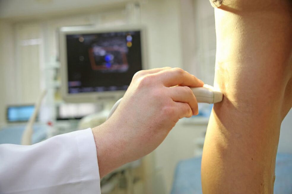 Ultrasound of the vein of the lower extremities