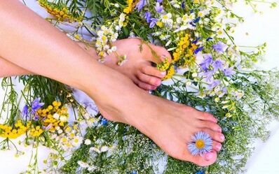How to treat varicose veins on your legs
