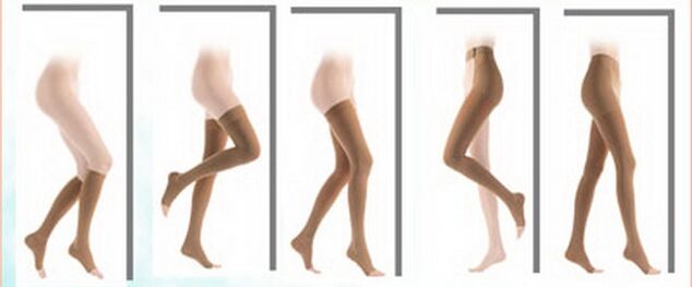 Types of compression stockings for varicose veins